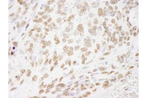 Immunohistochemistry (IHC) image for anti-Histone H3 (H3) (C-Term) antibody (ABIN7448974)