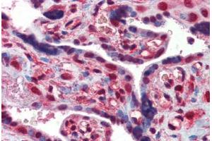 Placenta, Human: Formalin-Fixed, Paraffin-Embedded (FFPE)