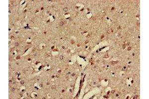 Immunohistochemistry of paraffin-embedded human brain tissue using ABIN7151843 at dilution of 1:100 (EPH Receptor A5 anticorps  (AA 246-514))