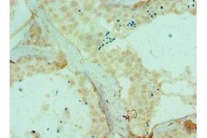 Immunohistochemistry of paraffin-embedded human testis tissue using ABIN7150791 at dilution of 1:100