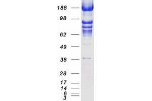 Validation with Western Blot