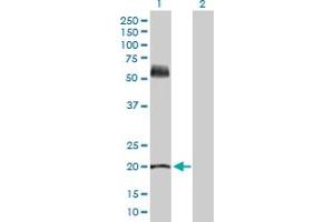 Western Blot analysis of KRT81 expression in transfected 293T cell line by KRT81 MaxPab polyclonal antibody. (KRT81 anticorps  (AA 1-202))