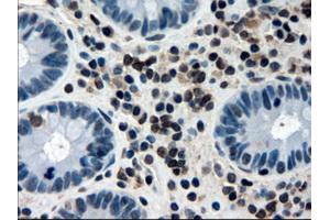 Immunohistochemical staining of paraffin-embedded colon using anti-APOM (ABIN2452530) mouse monoclonal antibody. (Apolipoprotein M anticorps  (AA 23-188))
