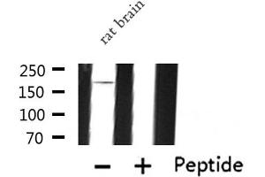 Western blot analysis of IQGAP1 expression in Rat brain lysate (IQGAP1 anticorps  (N-Term))