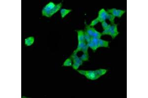 Immunofluorescence staining of 293 cells with ABIN7170440 at 1:66, counter-stained with DAPI. (SPTBN1 anticorps  (AA 2096-2256))