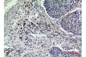 Immunohistochemistry (IHC) analysis of paraffin-embedded Human Lung, antibody was diluted at 1:100.