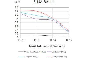anti-Ectonucleoside Triphosphate diphosphohydrolase 1 (ENTPD1) (AA 38-179) antibody