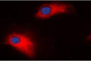 Immunofluorescent analysis of MMP8 staining in SW620 cells.