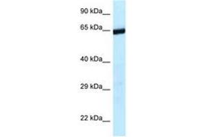 Image no. 1 for anti-Excision Repair Cross-Complementing Rodent Repair Deficiency, Complementation Group 6-Like 2 (ERCC6L2) (AA 1120-1169) antibody (ABIN6747427) (ERCC6L2 anticorps  (AA 1120-1169))