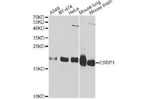 Western blot analysis of extracts of various cell lines, using CSRP1 Antibody. (CSRP1 anticorps  (AA 1-193))