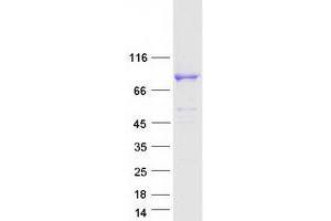 Validation with Western Blot