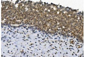 IHC analysis of EYA4 using anti-EYA4 antibody (ABIN7601063). (EYA4 anticorps  (AA 28-205))