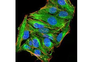 Immunofluorescence analysis of Hela cells using ATG13 mouse mAb (green).