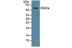Detection of ODC in Human Serum using Polyclonal Antibody to Ornithine Decarboxylase (ODC)