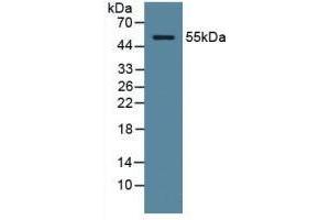 Detection of ODC in Human Serum using Polyclonal Antibody to Ornithine Decarboxylase (ODC) (ODC1 anticorps  (AA 15-259))