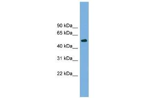 WB Suggested Anti-TUBB4 Antibody Titration: 0. (TUBB4 anticorps  (N-Term))