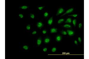 Immunofluorescence of monoclonal antibody to SUPT5H on HeLa cell.