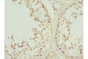 Immunohistochemistry of paraffin-embedded human testis tissue using ABIN7146876 at dilution of 1:100 (Casein Kinase 1 gamma 2 anticorps  (Isoform gamma 2))