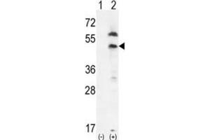 Western Blotting (WB) image for anti-Platelet-Derived Growth Factor Receptor-Like (PDGFRL) antibody (ABIN3003406) (PDGFRL anticorps)