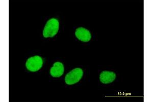 Immunofluorescence of purified MaxPab antibody to RPRD1A on HeLa cell. (RPRD1A anticorps  (AA 1-289))