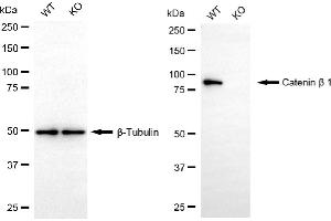 Western blotting analysis using catenin beta 1 antibody (ABIN7797927).
