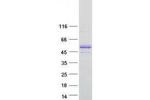 Validation with Western Blot