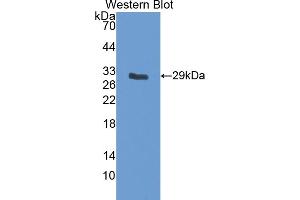 Western blot analysis of the recombinant protein. (IGFBP5 anticorps  (AA 25-271))