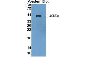 Western blot analysis of the recombinant protein. (Aquaporin 8 anticorps  (AA 129-228))