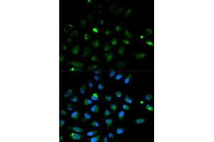Immunofluorescence analysis of HeLa cell using PRF1 antibody.