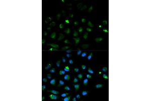 Immunofluorescence analysis of HeLa cell using PRF1 antibody. (Perforin 1 anticorps  (AA 280-555))