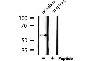 Western blot analysis of extracts from rat spleen, using Cytochrome P450 11A1 Antibody. (CYP11A1 anticorps  (C-Term))
