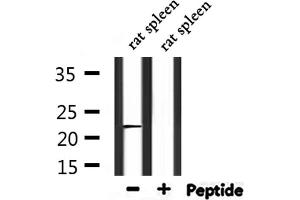 Western blot analysis of extracts from rat spleen, using C56D2 Antibody. (CYB561D2 anticorps)