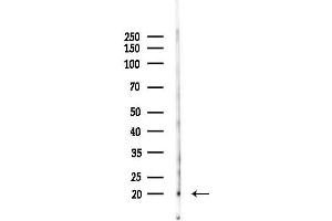 Western blot analysis of lysates from Mouse testis, using Phospho-Synuclein alpha (Tyr133) Antibody at 1/1000 dilution.