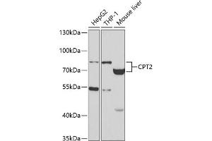 Western blot analysis of extracts of various cell lines, using CPT2 antibody (ABIN3023423, ABIN3023424, ABIN3023425 and ABIN6219865) at 1:400 dilution.