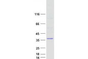 Validation with Western Blot