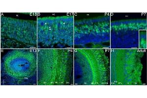 Dvl-2 is expressed in OSN, in all layers through the olfactory bulb and is associated with synapses inside the glomeruli.