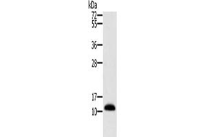 Gel: 10 % SDS-PAGE, Lysate: 40 μg, Lane: Human prostate tissue, Primary antibody: ABIN7130278(MSMB Antibody) at dilution 1/250, Secondary antibody: Goat anti rabbit IgG at 1/8000 dilution, Exposure time: 1 second (MSMB anticorps)