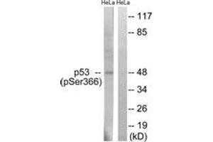 Western blot analysis of extracts from HeLa cells treated with Adriamycin 0. (p53 anticorps  (pSer366))