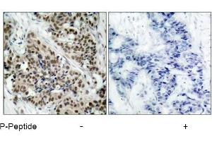 Image no. 3 for anti-Forkhead Box O1 (FOXO1) (pSer256) antibody (ABIN196813) (FOXO1 anticorps  (pSer256))