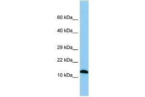 WB Suggested Anti-Spa17 Antibody Titration: 1. (SPA17 anticorps  (Middle Region))