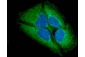 ICC/IF analysis of GARS in HeLa cells line, stained with DAPI (Blue) for nucleus staining and monoclonal anti-human GARS antibody (1:100) with goat anti-mouse IgG-Alexa fluor 488 conjugate (Green).