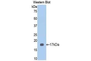 WB of Protein Standard: different control antibodies  against Highly purified E. (KNG1 Kit ELISA)