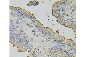 Immunohistochemistry of paraffin-embedded Human prostate using AZGP1 Polyclonal Antibody at dilution of 1:100 (40x lens). (AZGP1 anticorps)