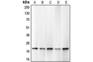 Western blot analysis of Caspase 1 expression in HEK293T PMA-treated (A), THP1 (B), HL60 (C), mouse lung (D), rat lung (E) whole cell lysates. (Caspase 1 anticorps  (Center))