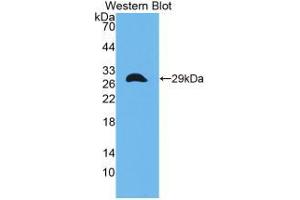 Western blot analysis of the recombinant protein. (CITED1 anticorps  (C-Term))
