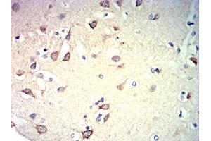 Immunohistochemical analysis of paraffin-embedded brain tissues using CD57 mouse mAb with DAB staining.