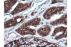 Immunohistochemical staining of paraffin-embedded Human Kidney tissue using anti-ENPEP mouse monoclonal antibody. (ENPEP anticorps)