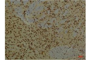 Immunohistochemical analysis of paraffin-embedded Mouse BrainTissue using HIF-1 β/ARNT Mouse mAb diluted at 1:200. (ARNT anticorps)