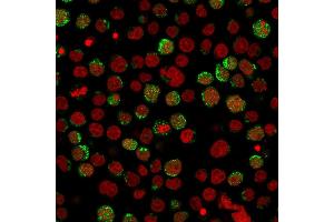 Immunofluorescent staining of paraformaldehyde-fixed Jurkat cells using CD40L Mouse Monoclonal Antibody (CD40LG/2761) followed by goat anti-Mouse IgG conjugated to CF488 (green). (CD40 Ligand anticorps  (AA 108-261))