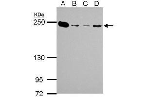 WB Image MYH9 antibody [N1], N-term detects MYH9 protein by Western blot analysis.